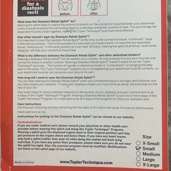 Tupler technique belly band - Picture 3 of 3